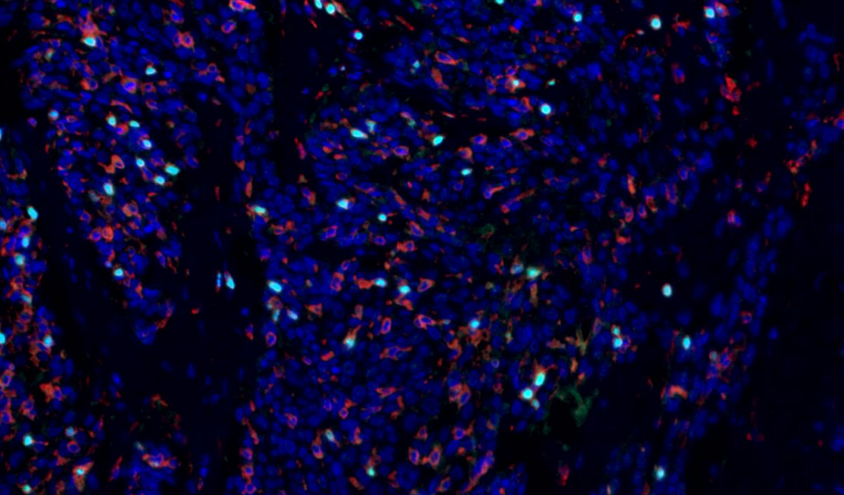 Absin 3-Color IHC Kit (Anti-Rabbit Secondary Antibody)