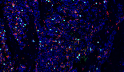 Absin 3-Color IHC Kit (Anti-Rabbit Secondary Antibody)