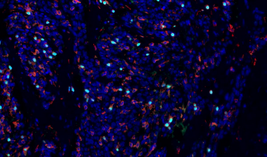 Absin 3-Color IHC Kit (Anti-Rabbit Secondary Antibody)