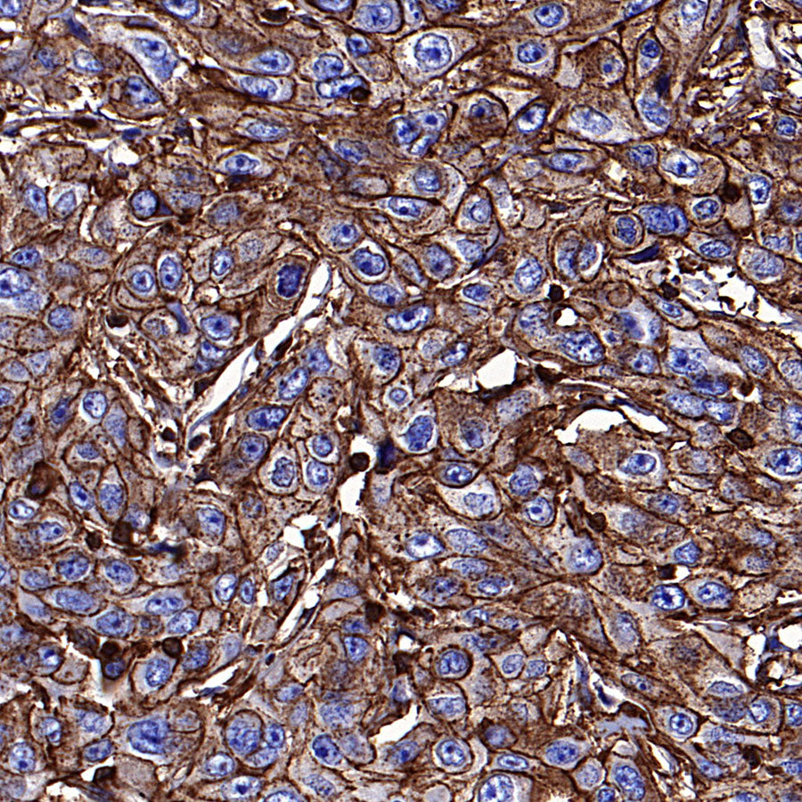 β-Actin Recombinant Rabbit mAb (S-5701)