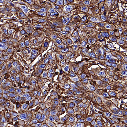 β-Actin Recombinant Rabbit mAb (S-5701)