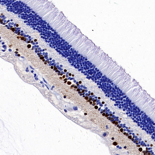 PAX6 Recombinant Rabbit mAb (SDT-1258-145)