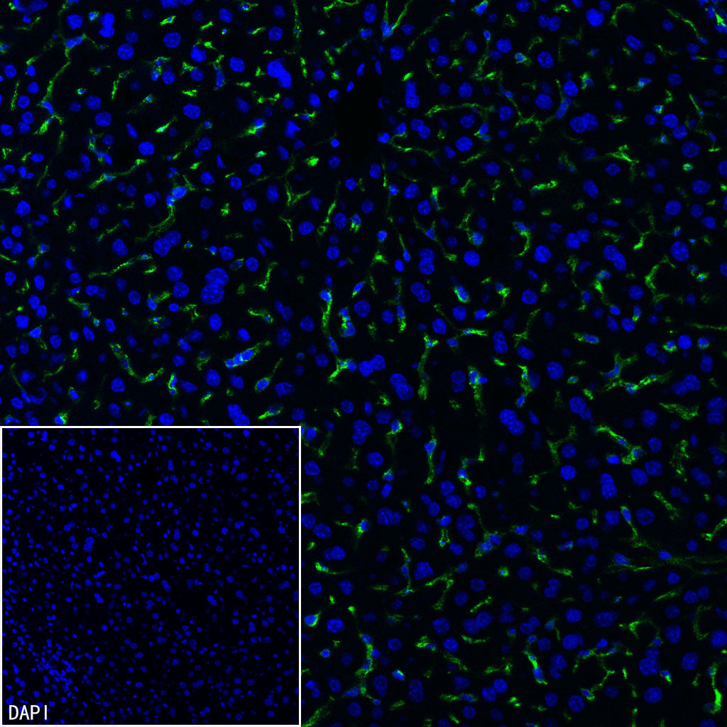 CD206 Recombinant Rabbit mAb (S-3477-27)