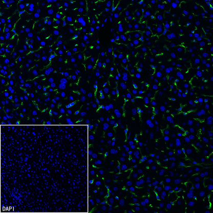 CD206 Recombinant Rabbit mAb (S-3477-27)