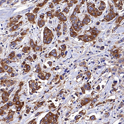 Hamartin/TSC1 Recombinant Rabbit mAb (S-2725-166)