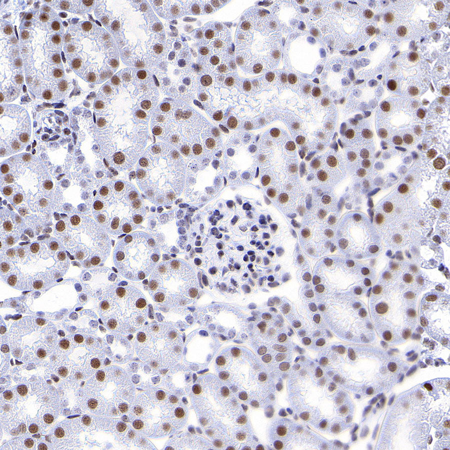 RBBP4 Rabbit Polyclonal Antibody