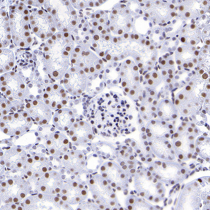 RBBP4 Rabbit Polyclonal Antibody