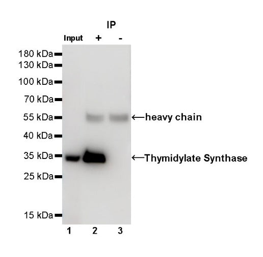 Thymidylate Synthase Recombinant Rabbit mAb (S-753-7)