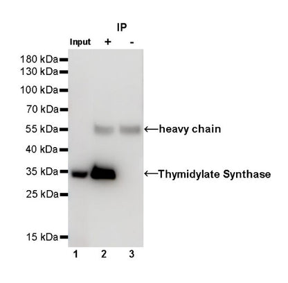 Thymidylate Synthase Recombinant Rabbit mAb (S-753-7)