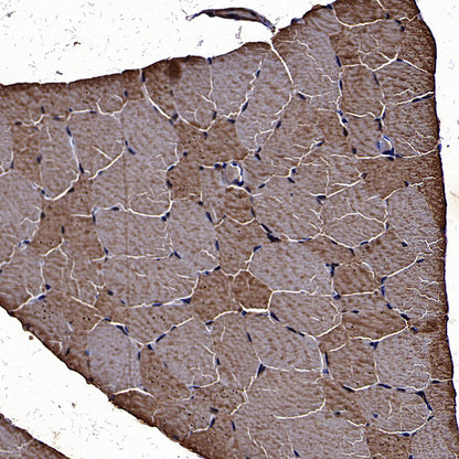 ALDOA Mouse mAb