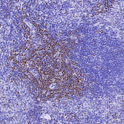 TCF1/TCF7 Recombinant Rabbit mAb (S-3486)