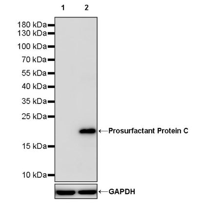 Prosurfactant Protein C Recombinant Rabbit mAb (S-1773-6)
