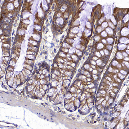 Calpain 1 Recombinant Rabbit mAb (S-3797-41)