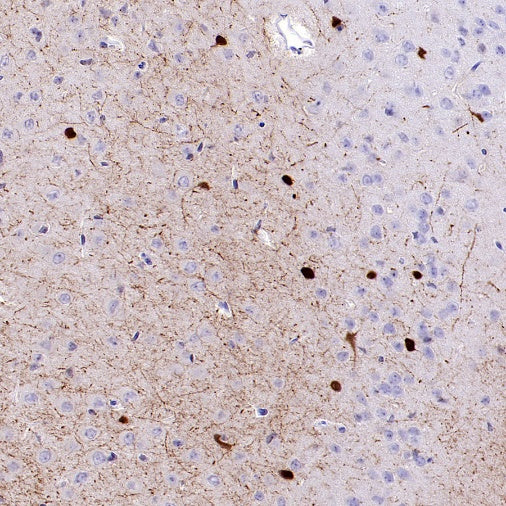 Calretinin Recombinant Rabbit mAb (SDT-2773-21)