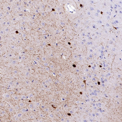 Calretinin Recombinant Rabbit mAb (SDT-2773-21)