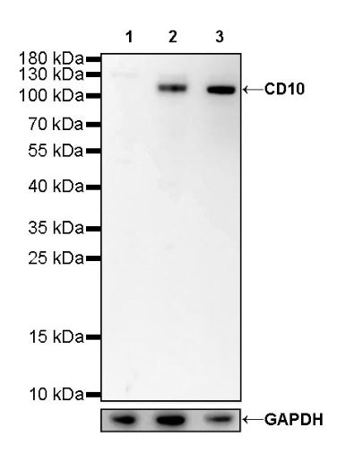 CD10 Recombinant Rabbit mAb (SDT-006-77)