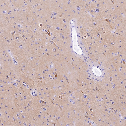 S-RMab® Pan Trk Recombinant Rabbit mAb (SDT-512-5)