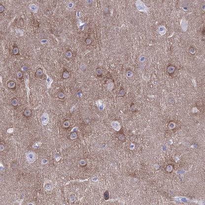 CaMKII-α/β Recombinant Rabbit mAb (S-R329)