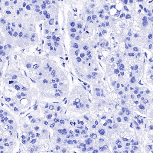 CA125 Recombinant Rabbit mAb (SDT-555-41)