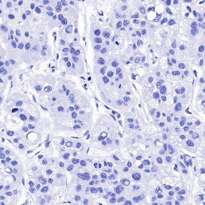 CA125 Recombinant Rabbit mAb (SDT-555-41)
