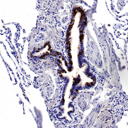 Uteroglobin Recombinant Rabbit mAb (SDT-2736-46)