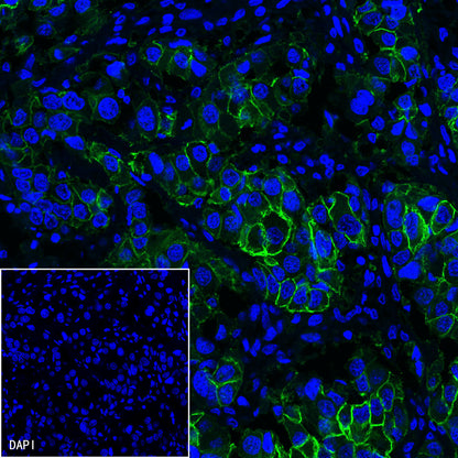 S-RMab® ErbB2 Recombinant Rabbit mAb (SDT-069-57)