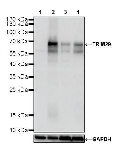 TRIM29 Recombinant Rabbit mAb (S-642-43)