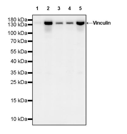 Vinculin Recombinant Rabbit mAb (S-1635-6)