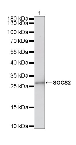 SOCS2 Recombinant Rabbit mAb (S-4956-21)