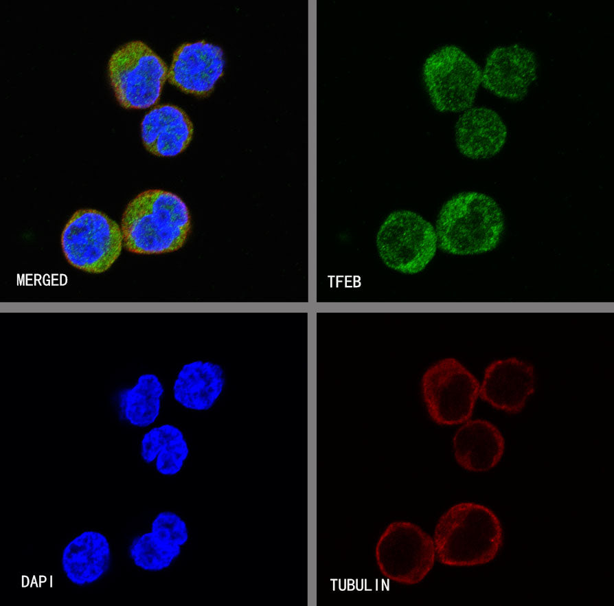 TFEB Recombinant Rabbit mAb (S-R296)