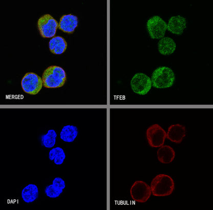 TFEB Recombinant Rabbit mAb (S-R296)