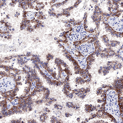 EGFR Recombinant Rabbit mAb (SDT-R110)