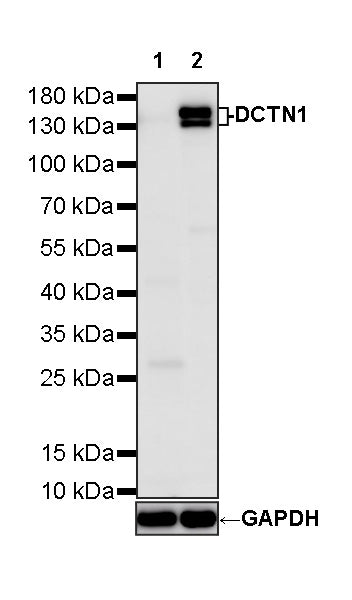 DCTN1 Rabbit Polyclonal Antibody