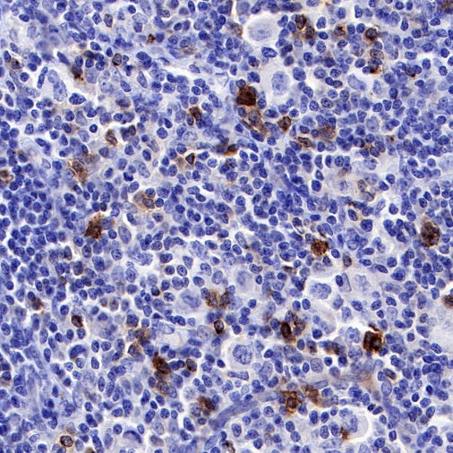 OX-40 Recombinant Rabbit mAb (S-R366)