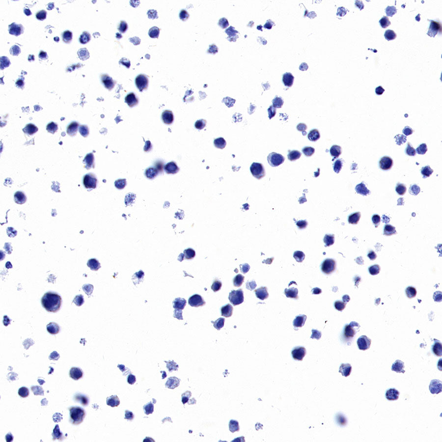 STEAP1+STEAP1B1+STEAP1B2 Recombinant Rabbit mAb (S-3226-137)
