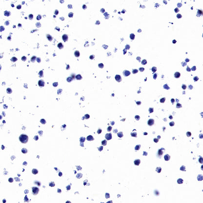 STEAP1+STEAP1B1+STEAP1B2 Recombinant Rabbit mAb (S-3226-137)