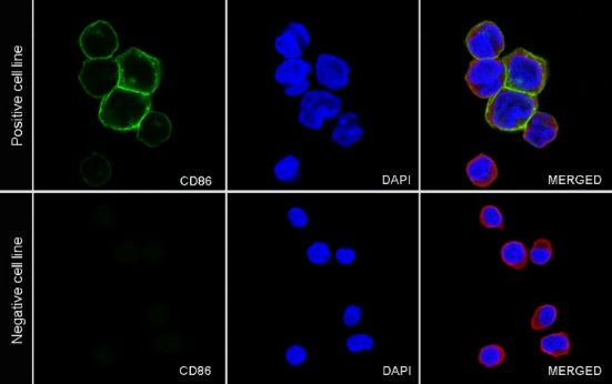 CD86 Recombinant Rabbit mAb (S-990-1)