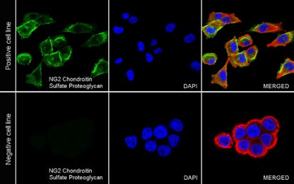 NG2 Chondroitin Sulfate Proteoglycan Recombinant Rabbit mAb (S-1233-25)