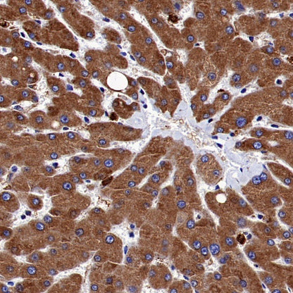 BiP Rabbit Polyclonal Antibody