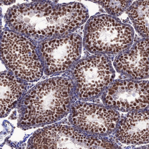 EWSR1/EWS Recombinant Rat mAb (S-R201)