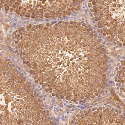 IFT88 Recombinant Rabbit mAb (S-2187-107)