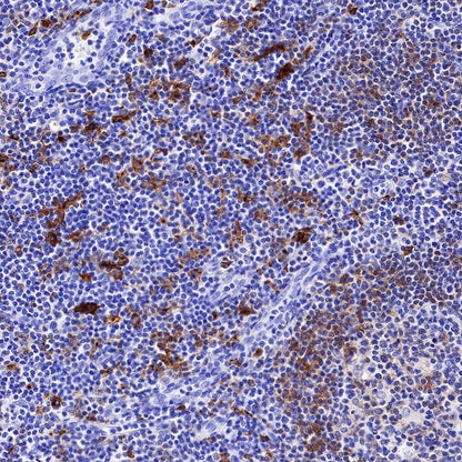 HLA-DP alpha1 Recombinant Rabbit mAb (S-R243)
