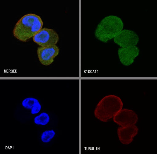 S100A11 Recombinant Rabbit mAb (S-821-4)