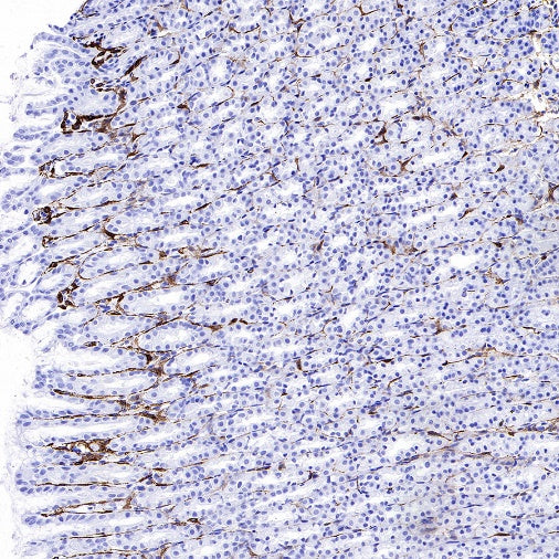 PDGFR alpha Recombinant Rabbit mAb (SDT-3353)