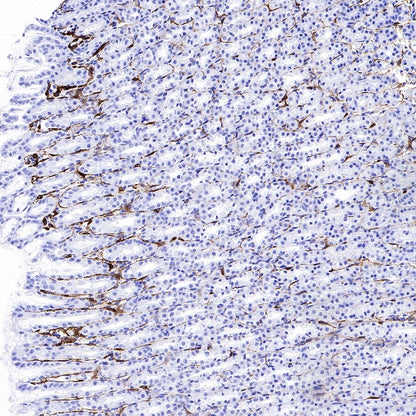 PDGFR alpha Recombinant Rabbit mAb (SDT-3353)