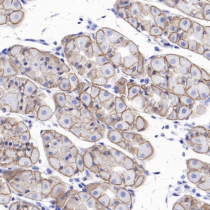 Non-phospho (Active) β-Catenin (Ser37/Thr41) Recombinant Rabbit mAb (S-1813-42)