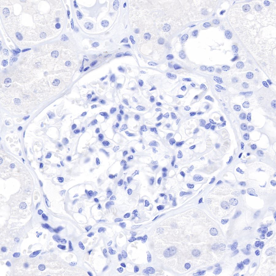CDX2 Recombinant Rabbit mAb (SDT-134-76)