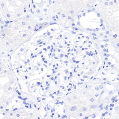 CDX2 Recombinant Rabbit mAb (SDT-134-76)
