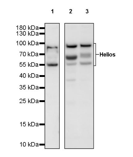Helios Recombinant Rabbit mAb (S-1299-31)