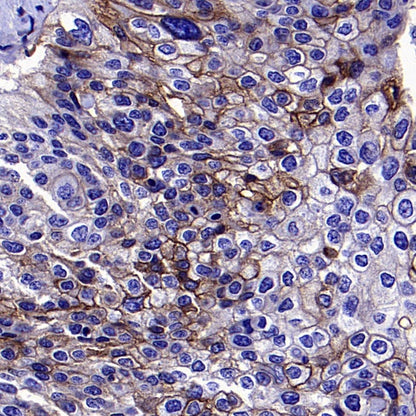 CMTM6 Recombinant Rabbit mAb (S-2013-4)